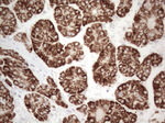 AMACR Antibody in Immunohistochemistry (Paraffin) (IHC (P))