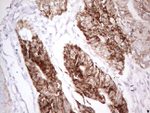 AMACR Antibody in Immunohistochemistry (Paraffin) (IHC (P))