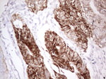 AMACR Antibody in Immunohistochemistry (Paraffin) (IHC (P))