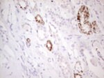 AMACR Antibody in Immunohistochemistry (Paraffin) (IHC (P))