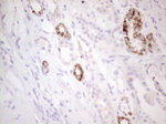 AMACR Antibody in Immunohistochemistry (Paraffin) (IHC (P))