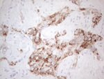 AMACR Antibody in Immunohistochemistry (Paraffin) (IHC (P))