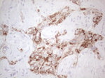 AMACR Antibody in Immunohistochemistry (Paraffin) (IHC (P))