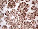 AMACR Antibody in Immunohistochemistry (Paraffin) (IHC (P))