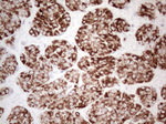 AMACR Antibody in Immunohistochemistry (Paraffin) (IHC (P))