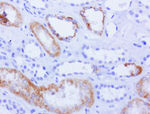 AMACR Antibody in Immunohistochemistry (Paraffin) (IHC (P))