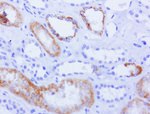 AMACR Antibody in Immunohistochemistry (Paraffin) (IHC (P))