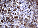 AMACR Antibody in Immunohistochemistry (Paraffin) (IHC (P))