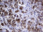AMACR Antibody in Immunohistochemistry (Paraffin) (IHC (P))