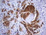 AMACR Antibody in Immunohistochemistry (Paraffin) (IHC (P))
