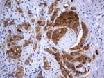 AMACR Antibody in Immunohistochemistry (Paraffin) (IHC (P))