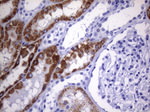 AMACR Antibody in Immunohistochemistry (Paraffin) (IHC (P))