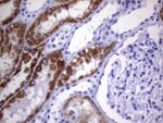 AMACR Antibody in Immunohistochemistry (Paraffin) (IHC (P))