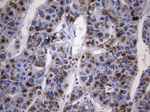AMACR Antibody in Immunohistochemistry (Paraffin) (IHC (P))