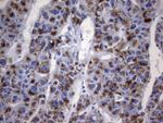 AMACR Antibody in Immunohistochemistry (Paraffin) (IHC (P))