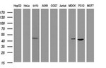 AMACR Antibody in Western Blot (WB)