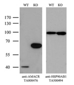 AMACR Antibody in Western Blot (WB)