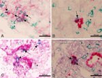 IFN gamma Antibody in Immunohistochemistry (IHC)