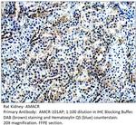 AMACR Polyclonal Antibody