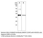AMACR Polyclonal Antibody