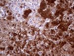 AMDHD1 Antibody in Immunohistochemistry (Paraffin) (IHC (P))