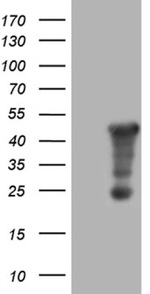 AMDHD1 Antibody in Western Blot (WB)