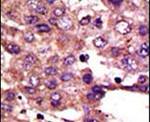 AMFR Antibody in Immunohistochemistry (IHC)