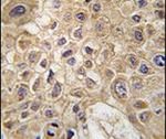 AMFR Antibody in Immunohistochemistry (IHC)