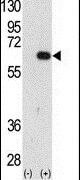 AMFR Antibody in Western Blot (WB)