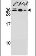 AMN1 Antibody in Western Blot (WB)