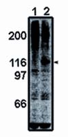 FAK Polyclonal Antibody