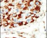 AMPK beta-1 Antibody in Immunohistochemistry (IHC)