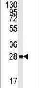 AMPK beta-1 Antibody in Western Blot (WB)