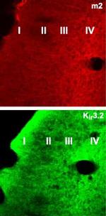 CHRM2 Polyclonal Antibody