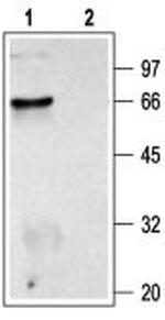 CHRM2 Antibody in Western Blot (WB)