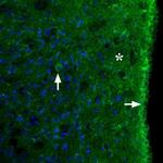 MC3 Receptor (extracellular) Polyclonal Antibody
