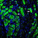 MRGPRD (GPCR TGR7) Antibody in Immunohistochemistry (IHC)