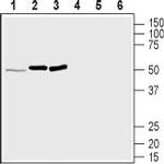 MRGPRD (GPCR TGR7) Antibody in Western Blot (WB)