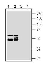MRGPRD (GPCR TGR7) Antibody in Western Blot (WB)