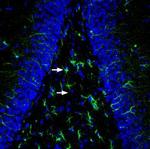 MRGPRE Polyclonal Antibody