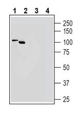 SLC18B1 (VPAT) Antibody in Western Blot (WB)