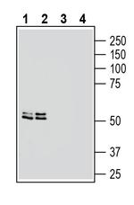SLC18B1 (VPAT) Antibody in Western Blot (WB)