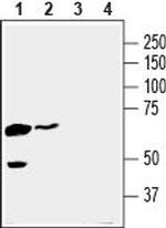 MCT4 (SLC16A3) Polyclonal Antibody