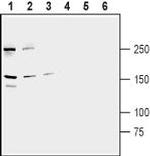 ABCB1/MDR1 Polyclonal Antibody