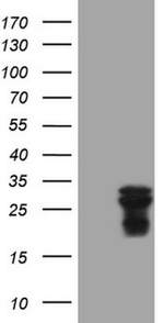 AMTN Antibody in Western Blot (WB)