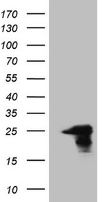 AMTN Antibody in Western Blot (WB)
