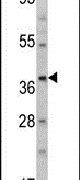 AMT Antibody in Western Blot (WB)