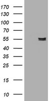 AMY2B Antibody in Western Blot (WB)