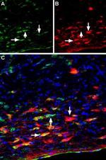 p75 NGF Receptor (extracellular) Antibody in Multiplex Immunohistochemistry (mIHC)