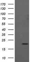 ANAPC11 Antibody in Western Blot (WB)